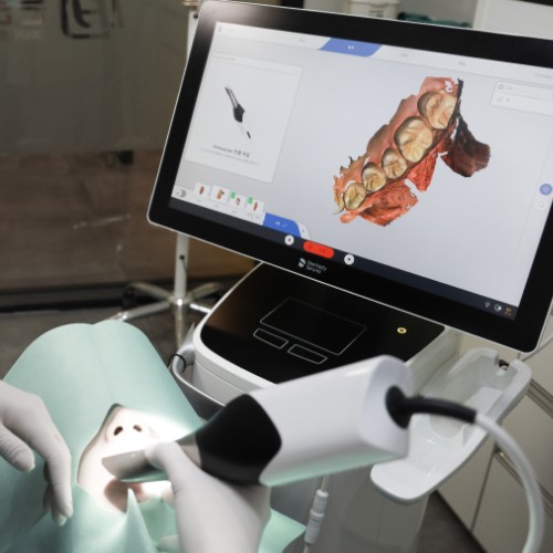 PRIME 3D 디지털 스캐너